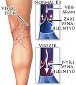 visszer.jpg